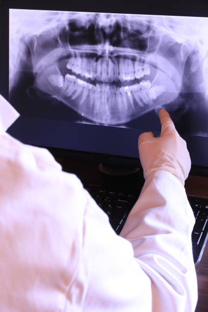 Best Emergency Tooth Extraction in Langdon, ND