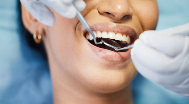 Best Emergency Root Canal Treatment in Langdon, ND
